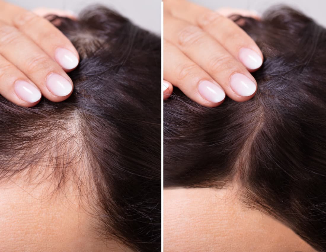 Best Collagen Supplements for Hair Your Key to a Rich Healthy
